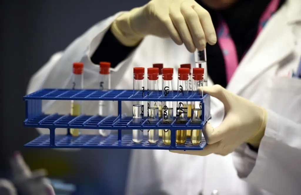 WADA запустило новую волну санкций в отношении спортсменов из РФ