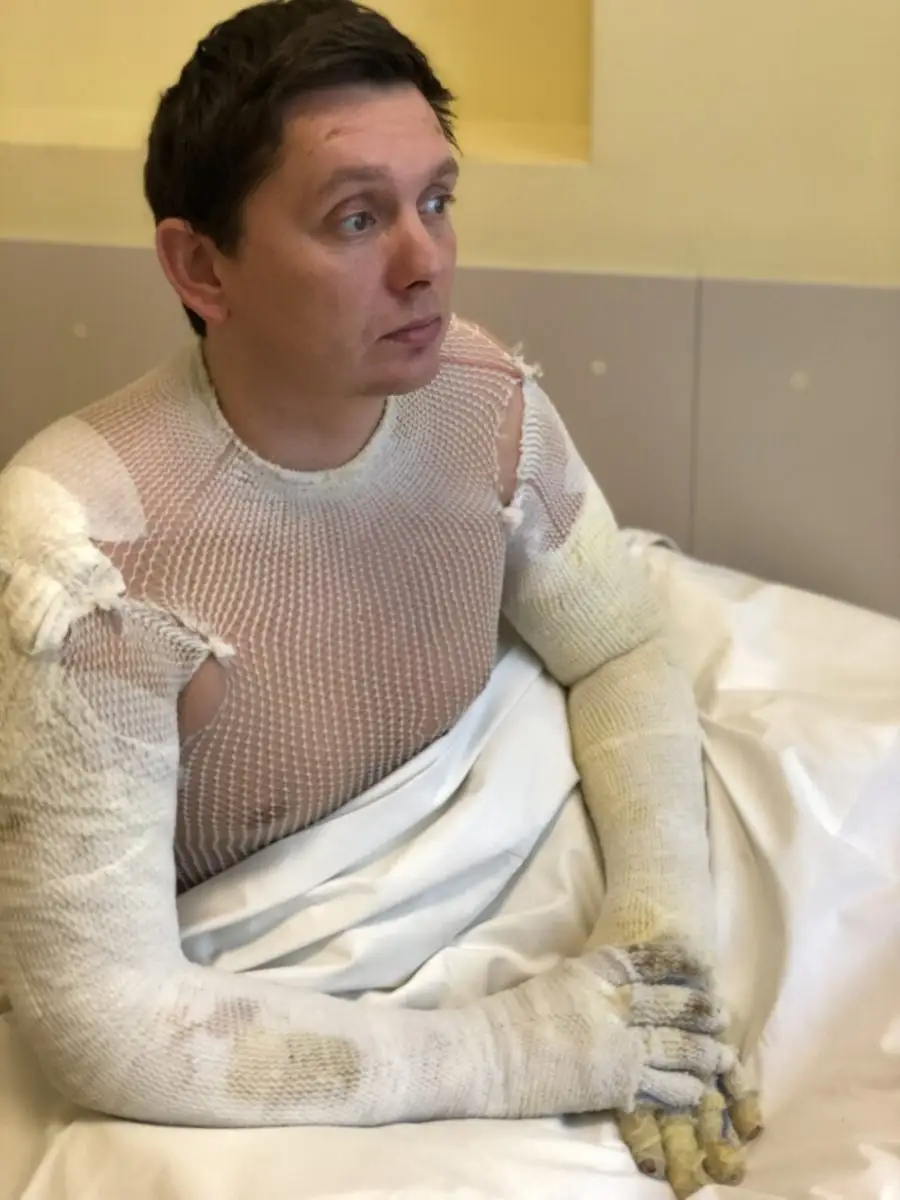 Policija atteikusies sākt kriminālprocesu par ugunsgrēku, kurā cieta deputāts Kaimiņš