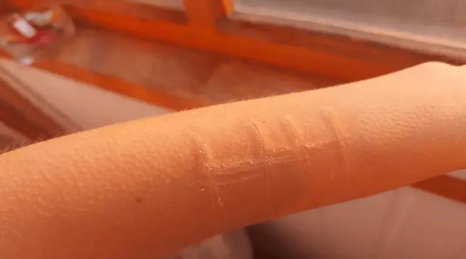 В России похитили сторонницу Навального и вырезали на ее руке букву «Н»