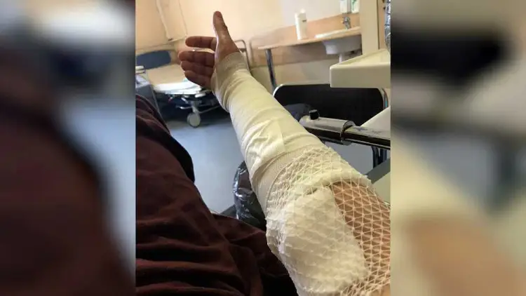 «Не дай бог, война»: в единственном в Латвии ожоговом центре осталось всего пять врачей