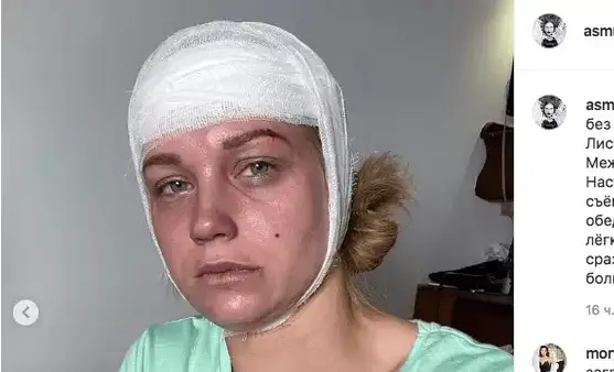 Кристина Асмус перепугала поклонников страшным фото