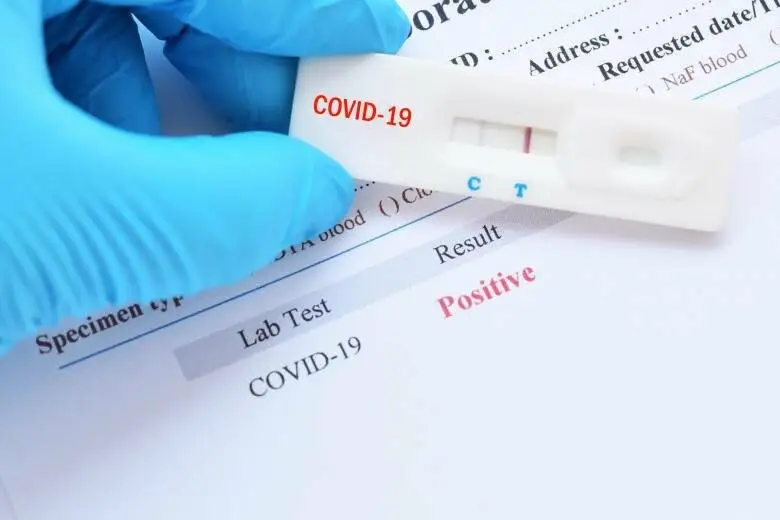 Aizvadītajā diennaktī Latvijā konstatēti 262 jauni Covid-19 gadījumi un ziņots par vienu mirušo