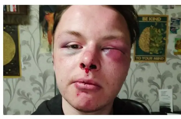 Reaģējot uz izbeigtu lietu par LGBT kopienas pārstāvja piekaušanu Daugavpilī, Stukāns lūdzis padotajiem skaidrojumus