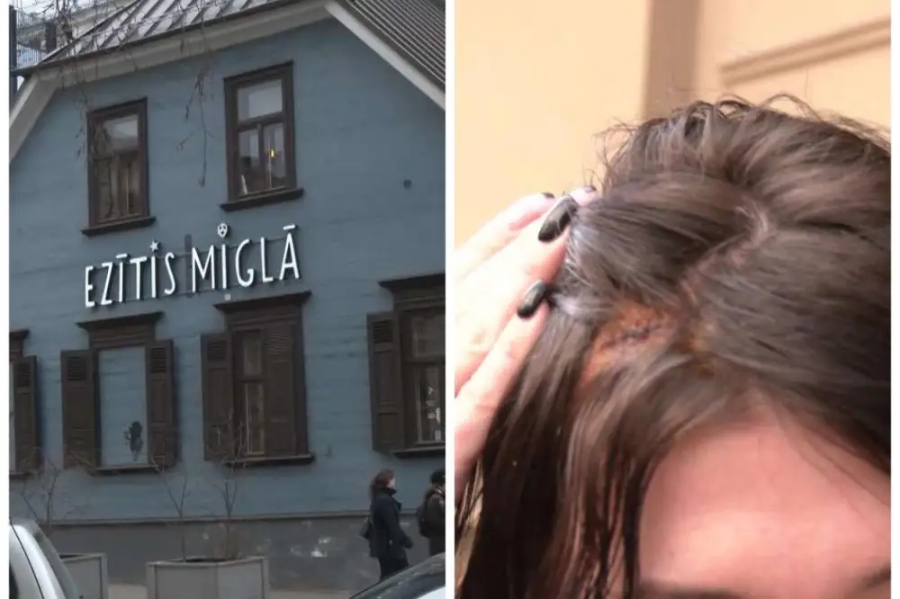 Пять швов на голове «в память» об известном кафе: рижанка в шоке