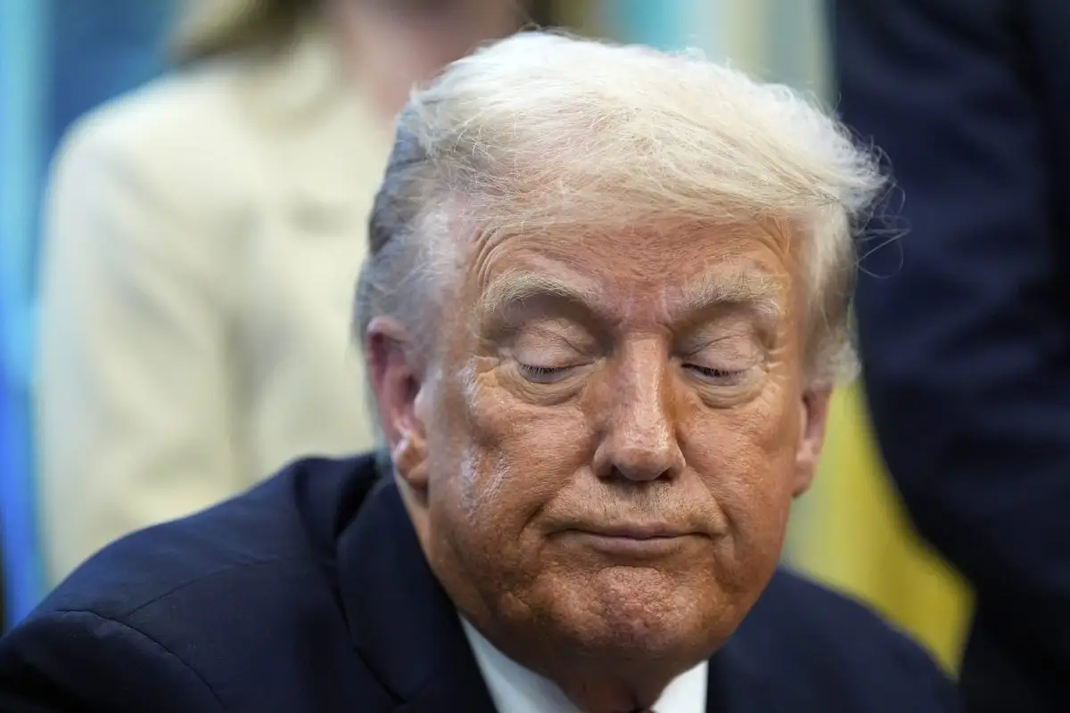 Дональд Трамп перенес операцию на голове: СМИ