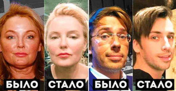 Выглядит на 30. Внезапно помолодевшие звезды, которых сложно узнать