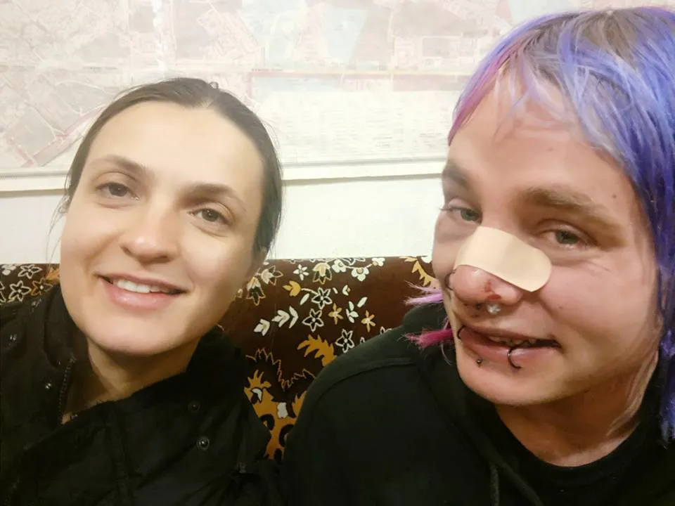 Британца избили в Киеве за внешность