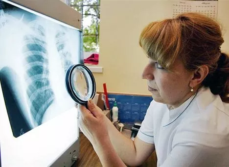 Tuberkulozes gadījumu skaits atgriezies pirmspandēmijas līmenī