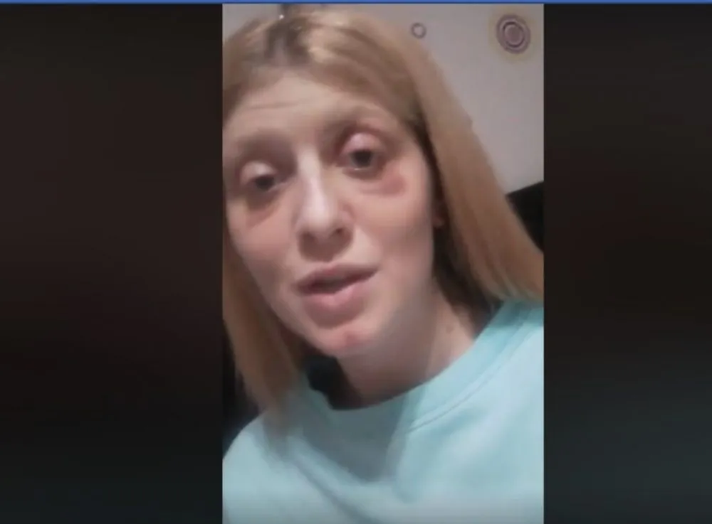 Били так, что болело все тело: спасенная в Египте певица рассказала о пережитом