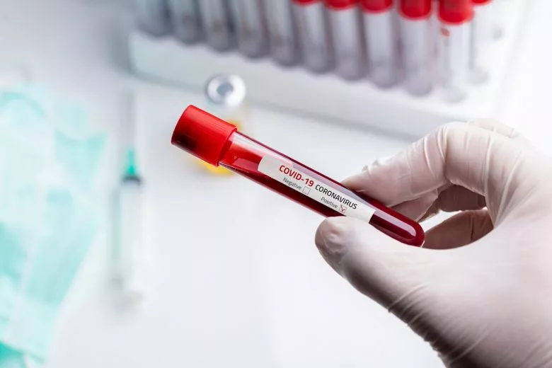 Asociācija: Covid-19 negatīvi ietekmē ar tiešo tirdzniecību nodarboties radušās zemnieku saimniecības