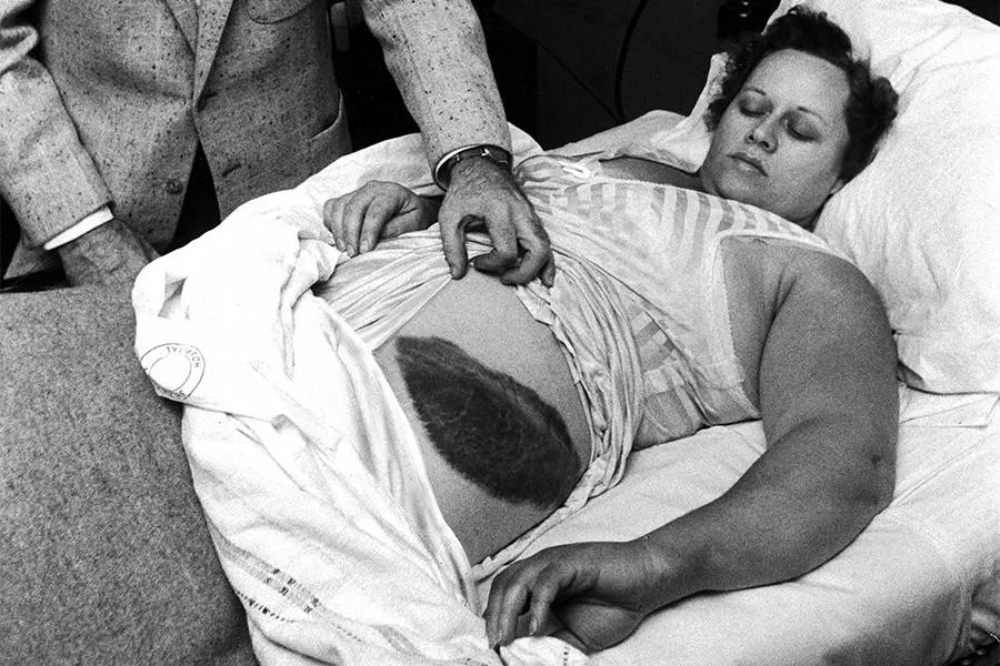 Энн Ходжес — единственный человек, пострадавший от прямого попадания метеорита
