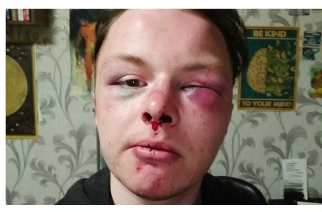Reaģējot uz izbeigtu lietu par LGBT kopienas pārstāvja piekaušanu Daugavpilī, Stukāns lūdzis padotajiem skaidrojumus