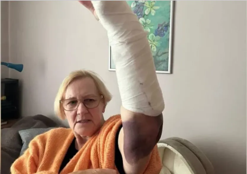Автоматическая дверь торгового центра в Риге сломала женщине руку в двух местах