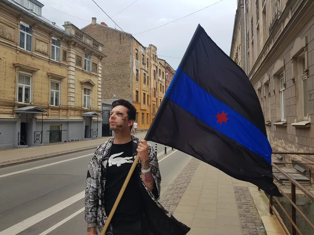 Назвали «пидором» и сломали челюсть. Артурс считает, что его избили из-за внешнего вида и предостерегает других