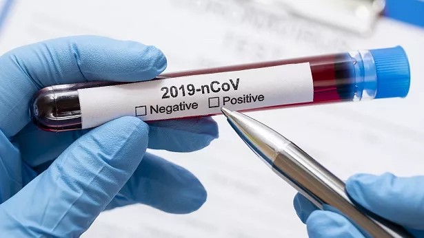 За сутки четверо умерших: данные по Covid-19 на понедельник