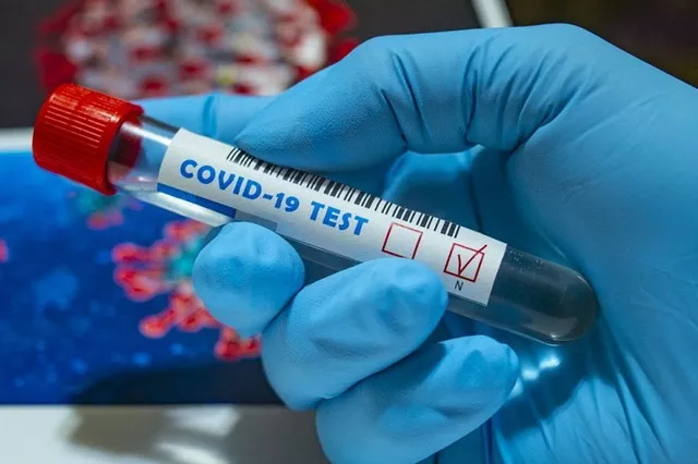 ЦПКЗ бьет тревогу: увеличилось количество новых случаев Covid-19