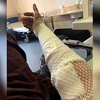 «Не дай бог, война»: в единственном в Латвии ожоговом центре осталось всего пять врачей