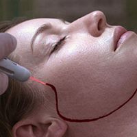 Уже не фантастика: пациентке пересадили чужое лицо — от человека после эвтаназии