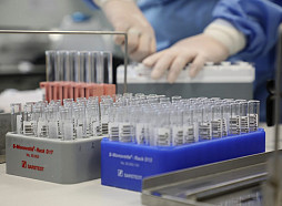 Aicina bez maksas veikt HIV testus