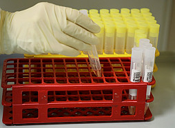 Aicina bez maksas veikt HIV, B un C hepatīta, kā arī sifilisa eksprestestus visā Latvijā