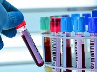 Простой анализ крови может обнаружить опухоль мозга! Учёные сделали неожиданный прорыв