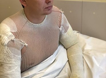 Policija atteikusies sākt kriminālprocesu par ugunsgrēku, kurā cieta deputāts Kaimiņš