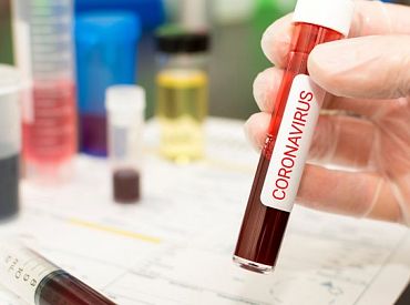 Ceturtdien Latvijā reģistrēti 458 Covid-19 gadījumi un ziņots par 1 mirušo