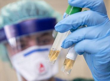 «E. Gulbja laboratorija» arī sagatavojusies Covid-19 antivielu noteikšanas testu veikšanai