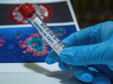 Pagājušajā diennaktī Latvijā atklāti seši Covid-19 gadījumi, viens pacients miris