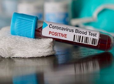 Svētdien Latvijā atklāti 89 Covid-19 gadījumi, bet trīs sasirgušie miruši