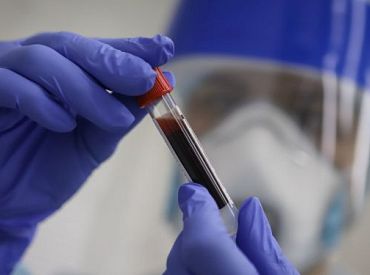 Ceturtdien Latvijā reģistrēti 666 jauni Covid-19 gadījumi, bet 16 sasirgušie miruši