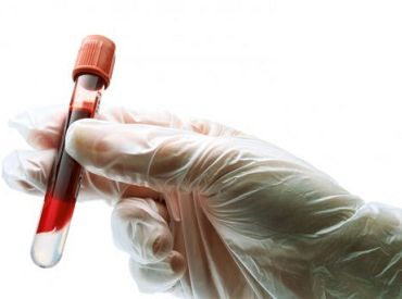 Austrumu slimnīcā varēs veikt bezmaksas aknu blīvuma mērīšanu un asins testēšanu uz C hepatītu