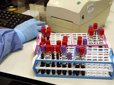 ВИЧ, гепатит, сифилис? Жителям Латвии предлагают бесплатно провериться