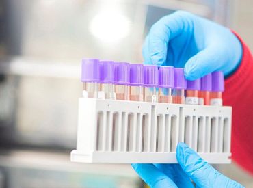 Svētdien Latvijā atklāti 178 Covid-19 gadījumi un divi sasirgušie miruši