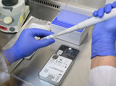 Pirmdien atklāti 1376 Covid-19 gadījumi un reģistrēti 13 Covid-19 pacientu nāves gadījumi