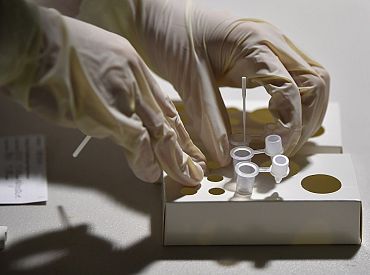 Brīvdienās sasniegts kopš aprīļa augstākais Covid-19 kumulatīvais rādītājs