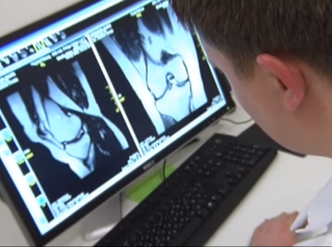 Хрящ может восстанавливаться? Учёные неожиданно пересматривают старое правило