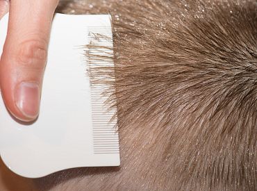 У детей вши, а садик не информирует родителей: как в Лиепае сражаются с педикулёзом