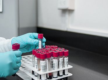 Государство будет оплачивать анализы. Жителей просят не паниковать