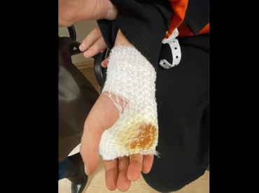 Ребенка порезали ножом у имантской школы: родители в поисках свидетеля