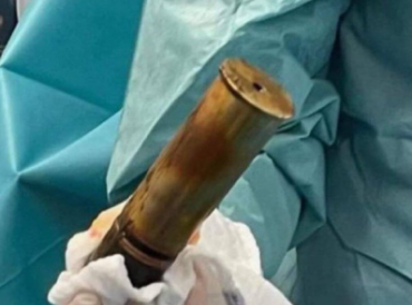 Попал в больницу со снарядом в анусе: клинику пришлось эвакуировать