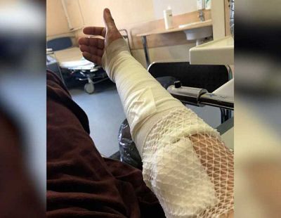«Не дай бог, война»: в единственном в Латвии ожоговом центре осталось всего пять врачей
