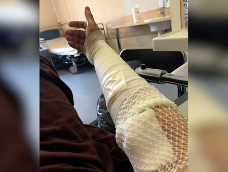 «Не дай бог, война»: в единственном в Латвии ожоговом центре осталось всего пять врачей