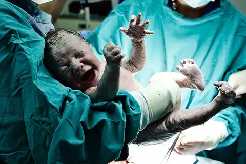 Роды могут стать невозможными без операций? Учёные бьют тревогу из-за изменений тела женщин