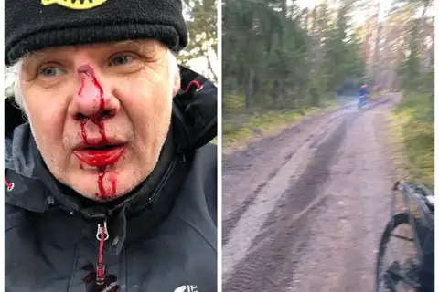 Борьба за зеленые дюны окончилась кровопролитием: защитника природы избил отец нарушителя