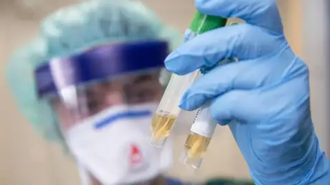 «E. Gulbja laboratorija» arī sagatavojusies Covid-19 antivielu noteikšanas testu veikšanai