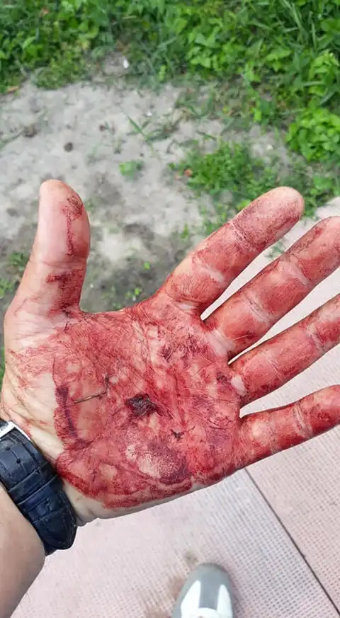 Думайте, куда выбрасывать мусор: собака вернулась из рижского леса вся в крови