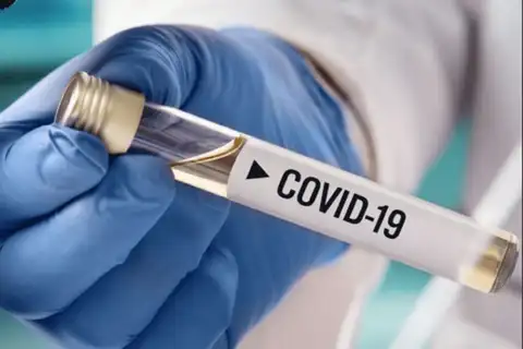 Nevakcinētajiem Covid-19 joprojām konstatē teju trīsreiz biežāk nekā pilnībā vakcinētajiem