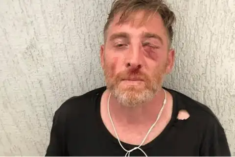 В Грузии умер телеоператор, избитый гомофобами на марше ЛГБТ