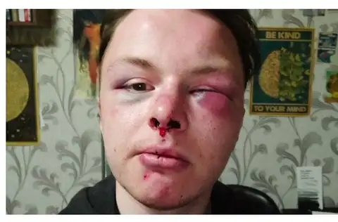 Дело в связи с избиением ЛГБТ-активиста в Даугавпилсе снова открыто